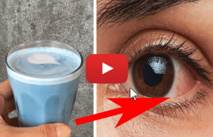 Discover more about supporting your vision